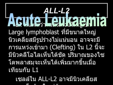 ALL-L2 ALL-L2 Acute Leukaemia