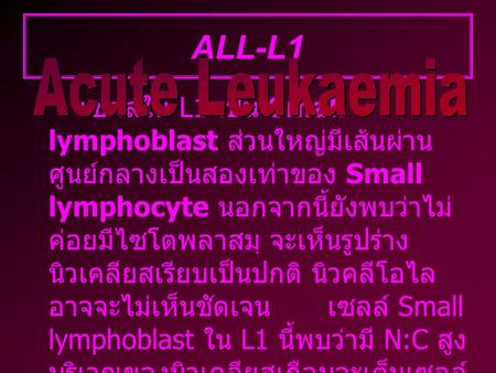 ALL-L1 ALL-L1 Acute Leukaemia