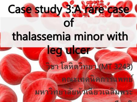 Case study 3:A rare case of thalassemia minor with leg ulcer