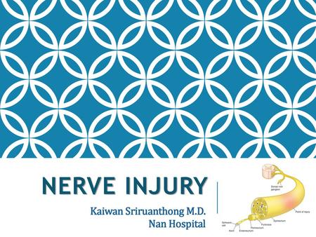 Nerve injury Kaiwan Sriruanthong M.D. Nan Hospital.
