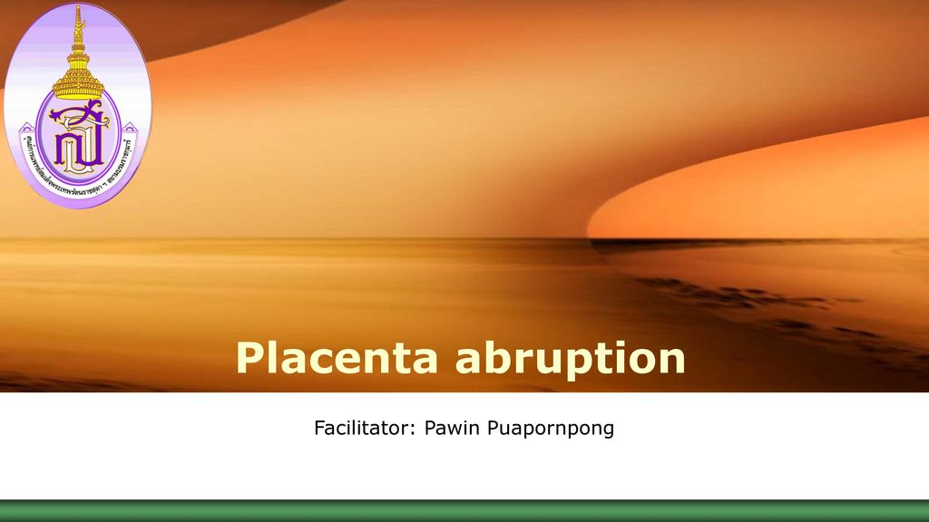 Facilitator: Pawin Puapornpong
