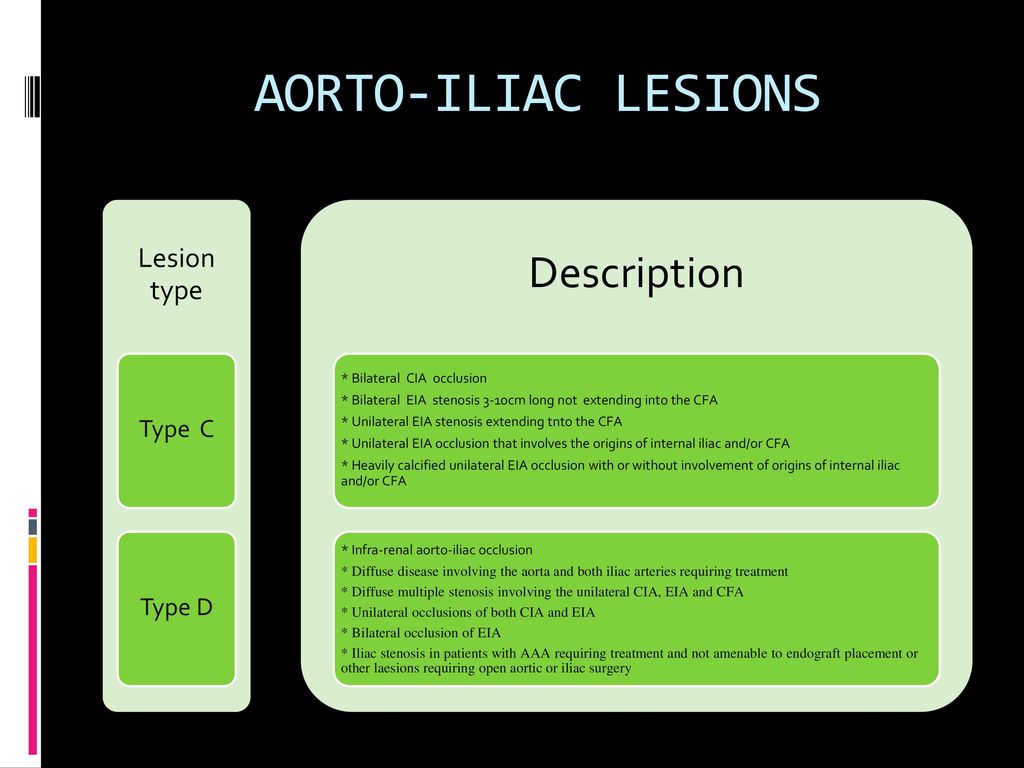 AORTO-ILIAC LESIONS Description Lesion type Type C Type D