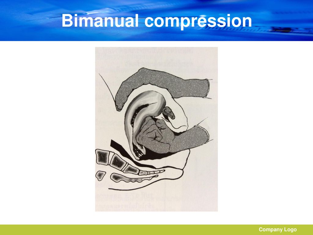 Bimanual compression Company Logo