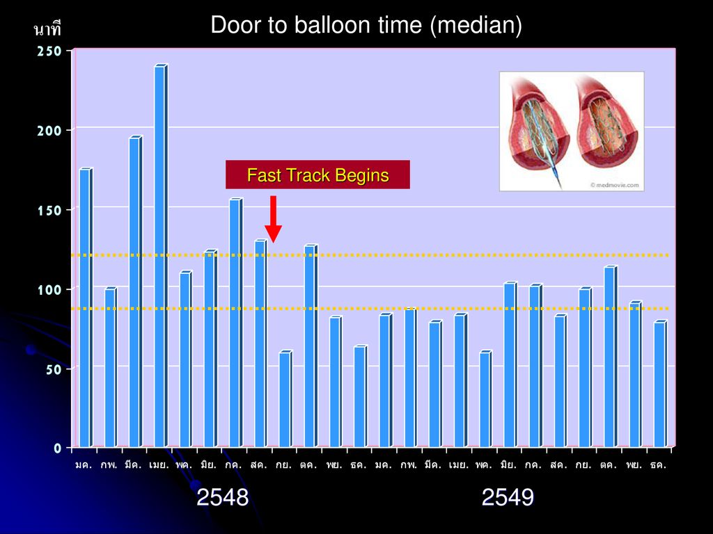 Door to balloon time (median)