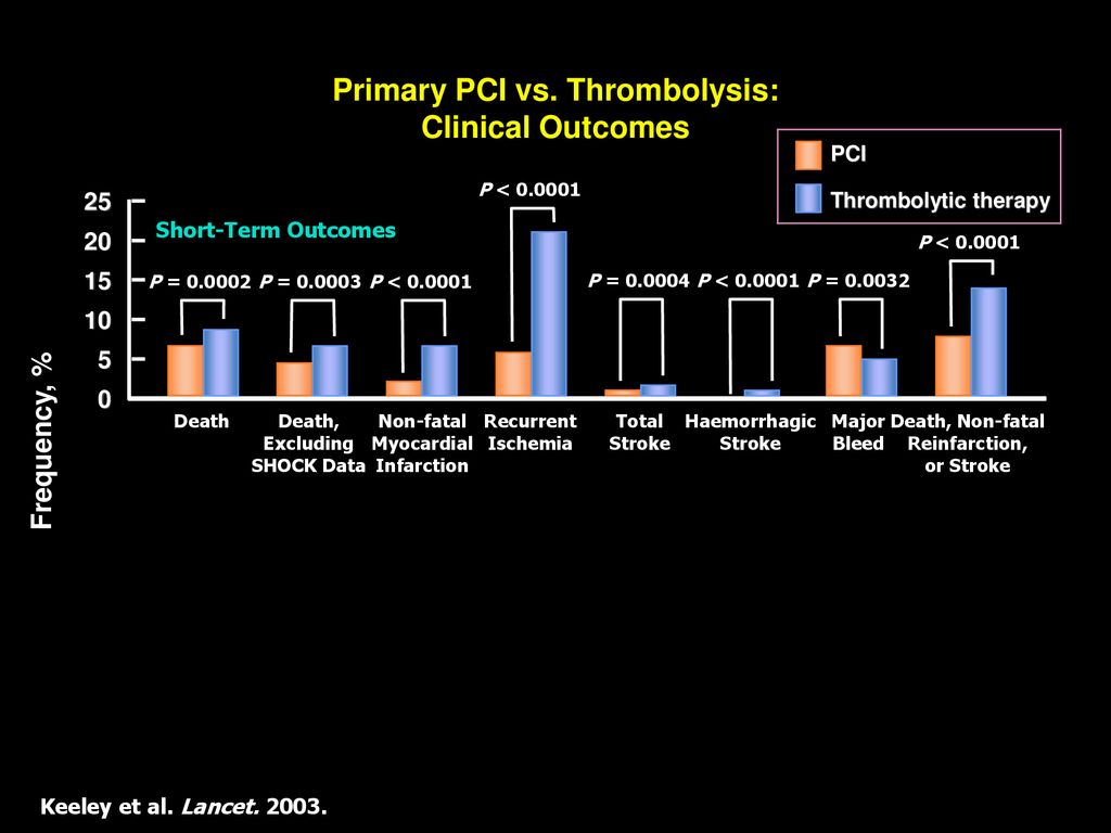 Primary PCI vs. Thrombolysis: Clinical Outcomes