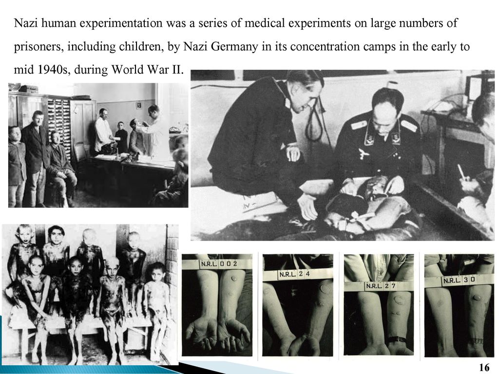 Nazi human experimentation was a series of medical experiments on large numbers of prisoners, including children, by Nazi Germany in its concentration camps in the early to mid 1940s, during World War II.