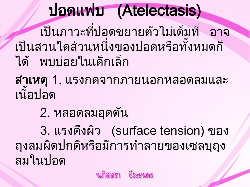 ปอดแฟบ (Atelectasis)