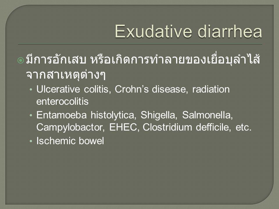 Exudative diarrhea มีการอักเสบ หรือเกิดการทำลายของเยื่อบุลำไส้จากสาเหตุต่างๆ. Ulcerative colitis, Crohn’s disease, radiation enterocolitis.