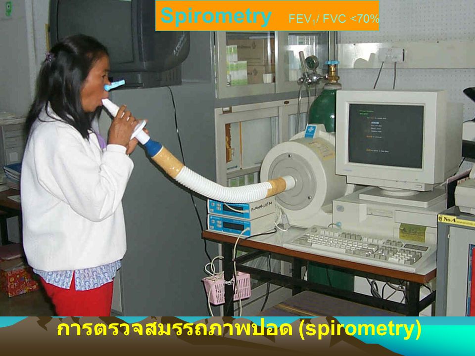 Spirometry FEV1/ FVC <70%