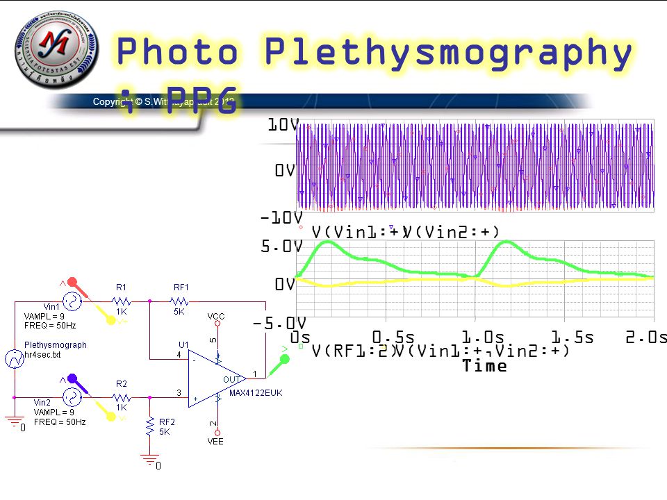 Photo Plethysmography ; PPG