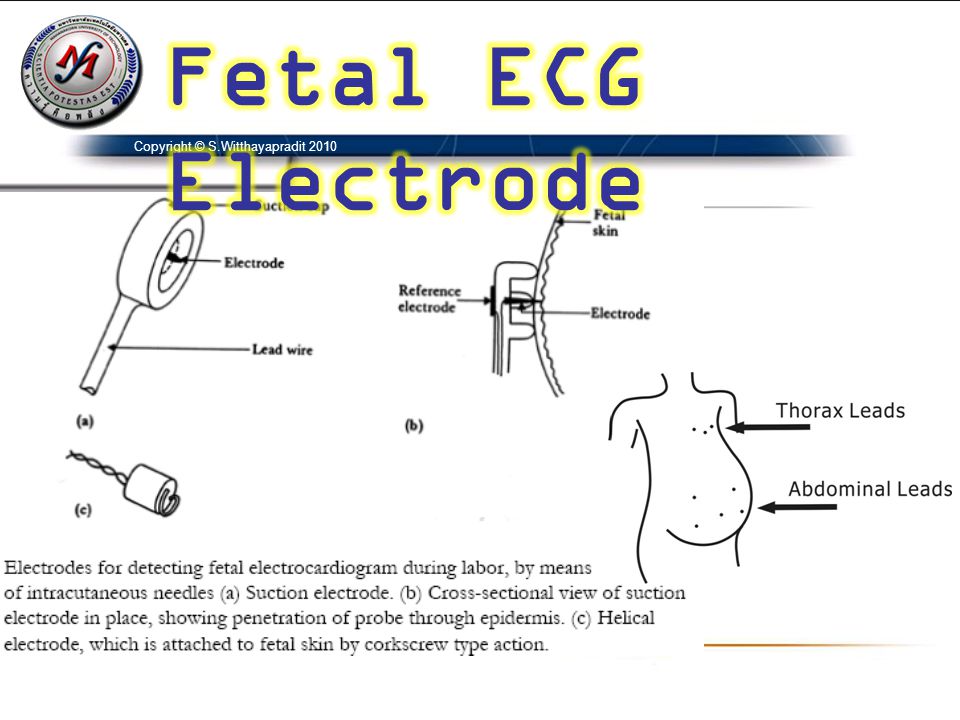 Fetal ECG Electrode Copyright © S.Witthayapradit 2010