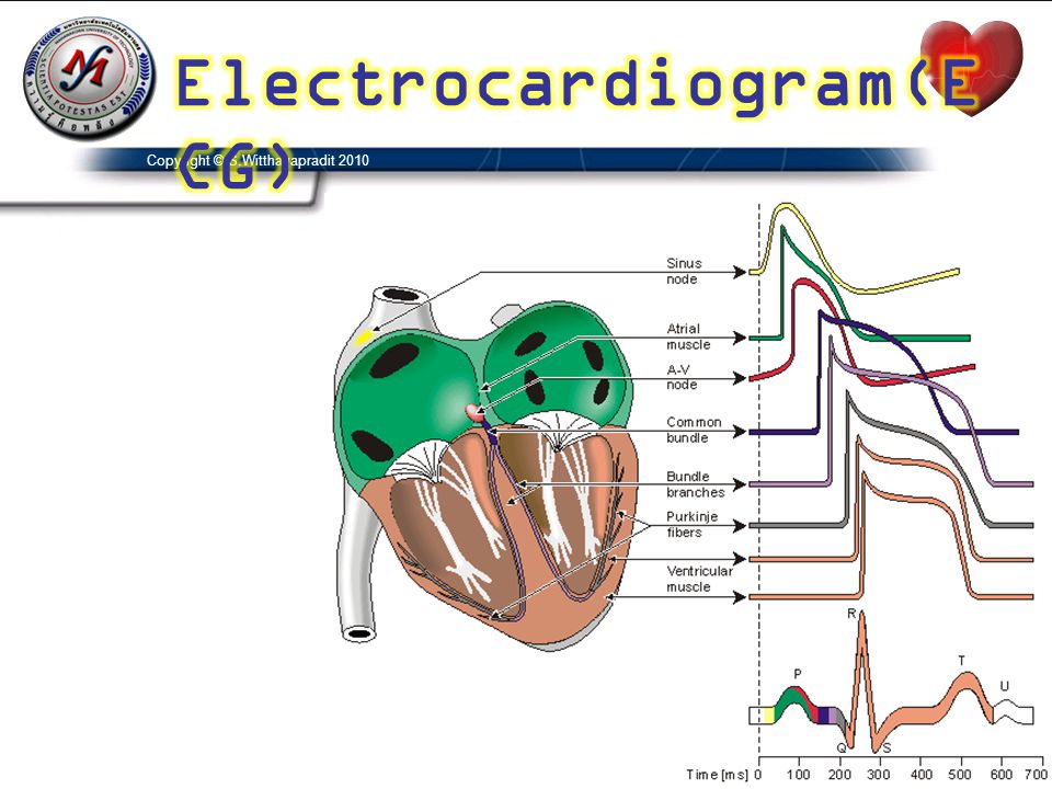 Electrocardiogram(ECG)