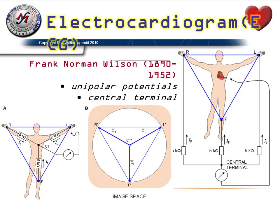Electrocardiogram(ECG)