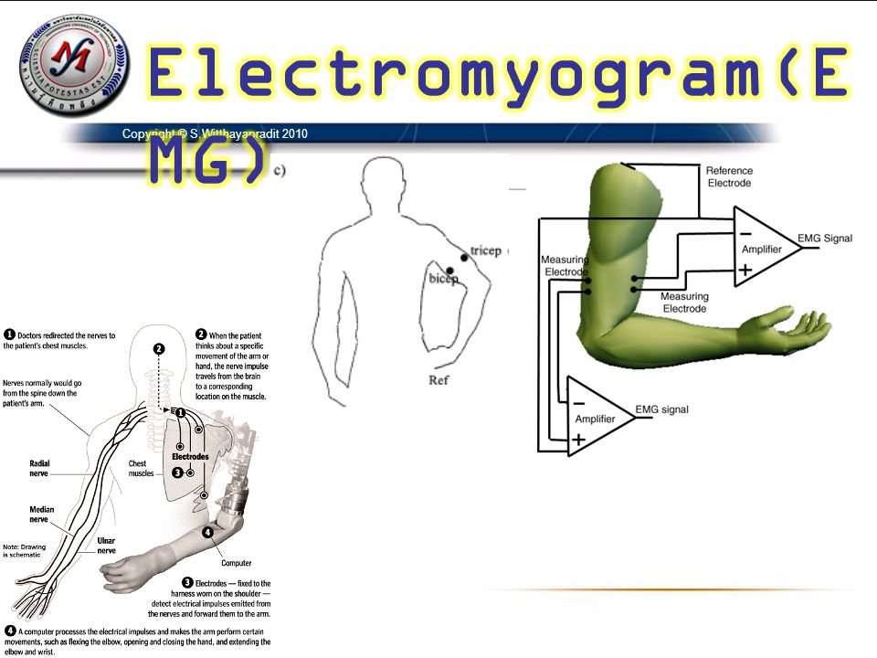 Electromyogram(EMG) Copyright © S.Witthayapradit 2010