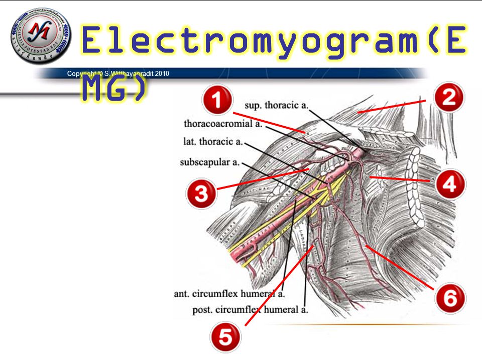 Electromyogram(EMG) Copyright © S.Witthayapradit 2010
