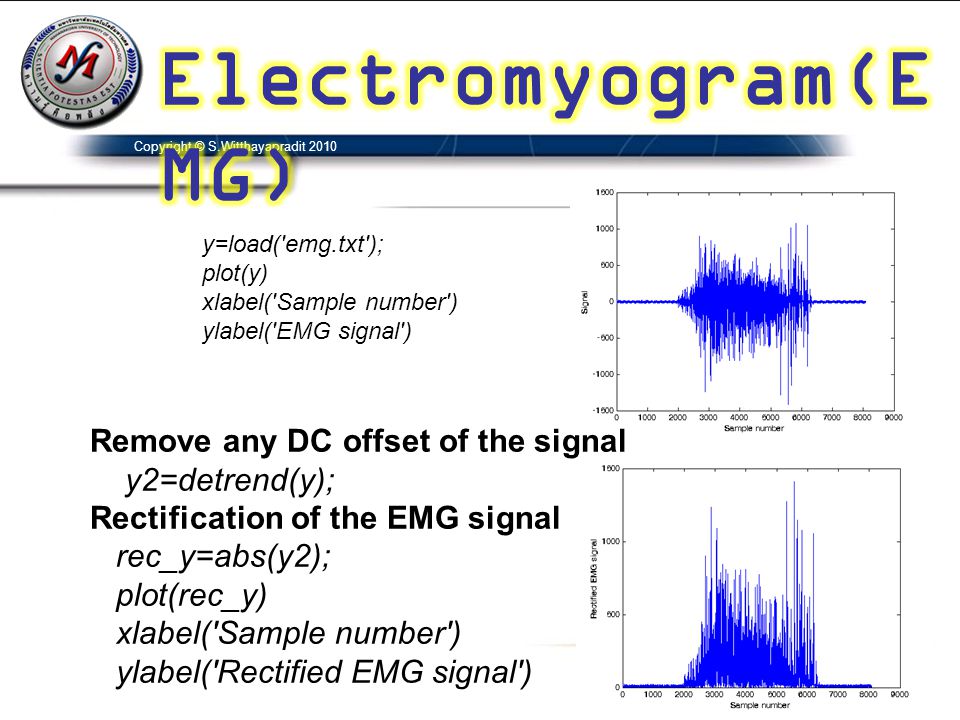 Electromyogram(EMG) Remove any DC offset of the signal y2=detrend(y);