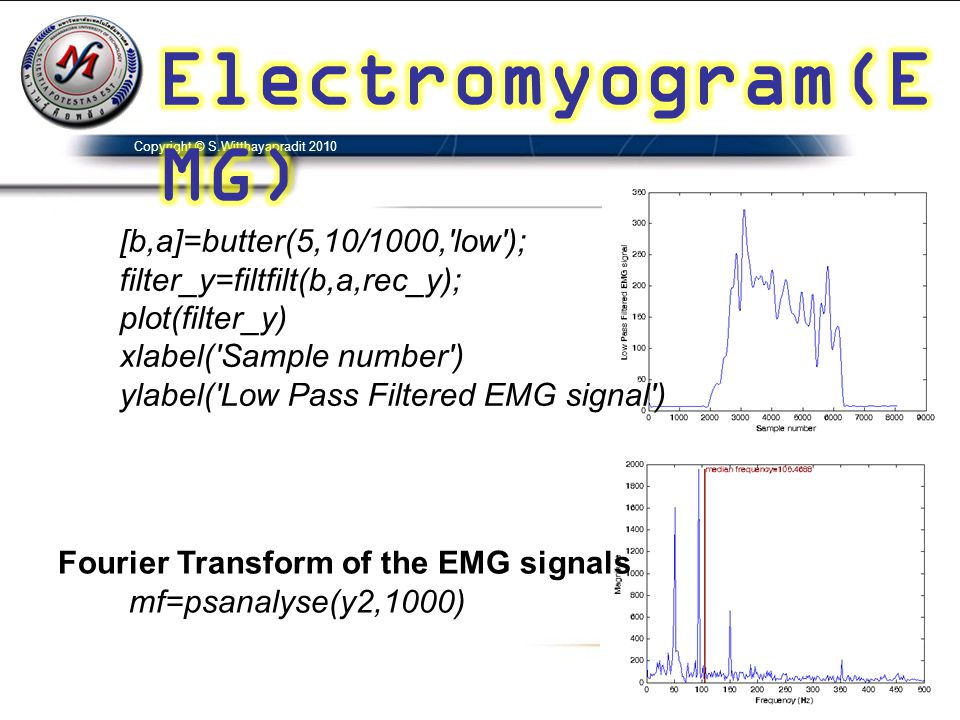 Electromyogram(EMG) [b,a]=butter(5,10/1000, low );