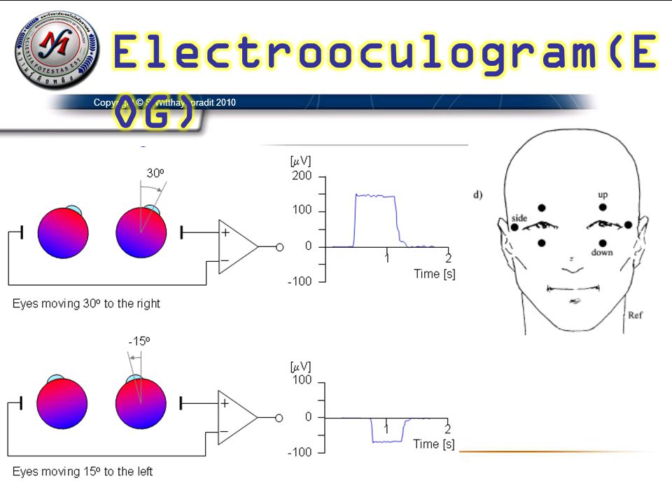 Electrooculogram(EOG)
