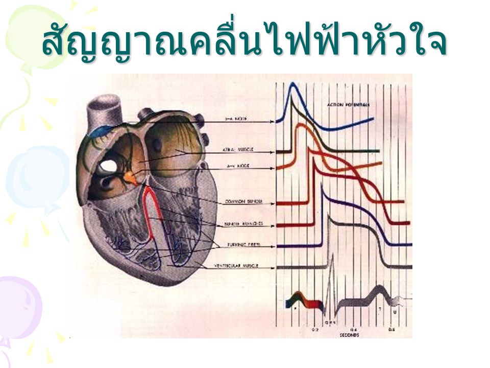 สัญญาณคลื่นไฟฟ้าหัวใจ