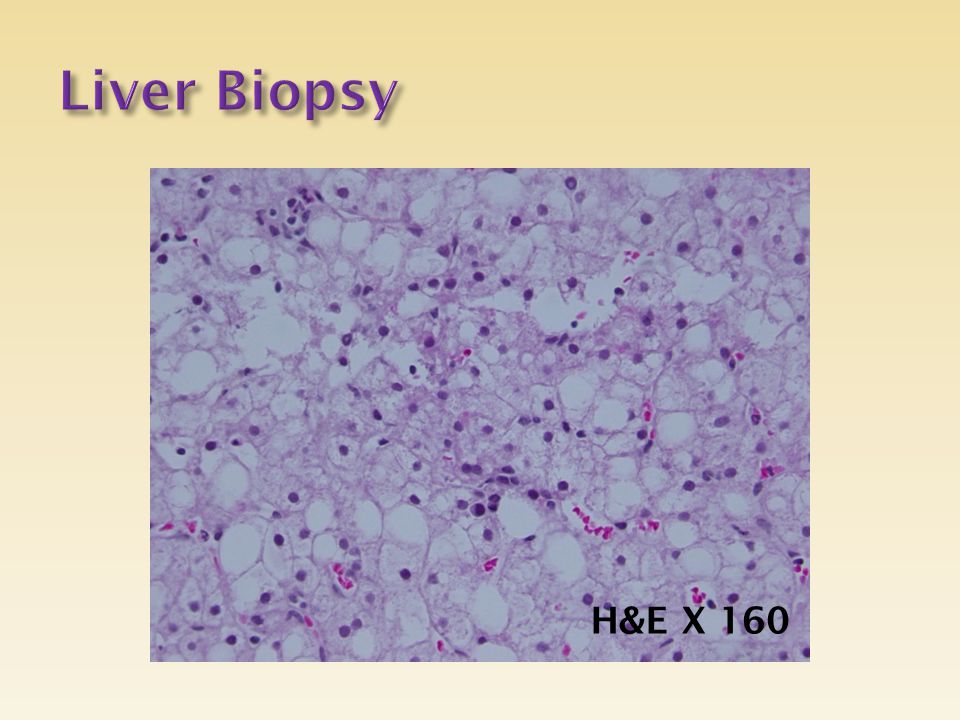 Liver Biopsy H&E X 160