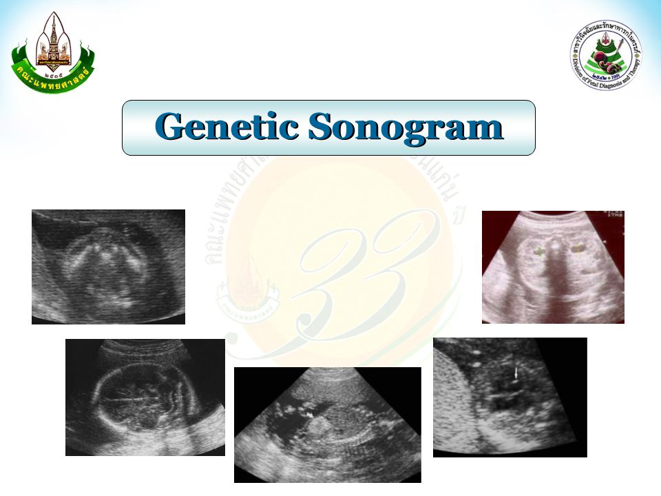 Genetic Sonogram