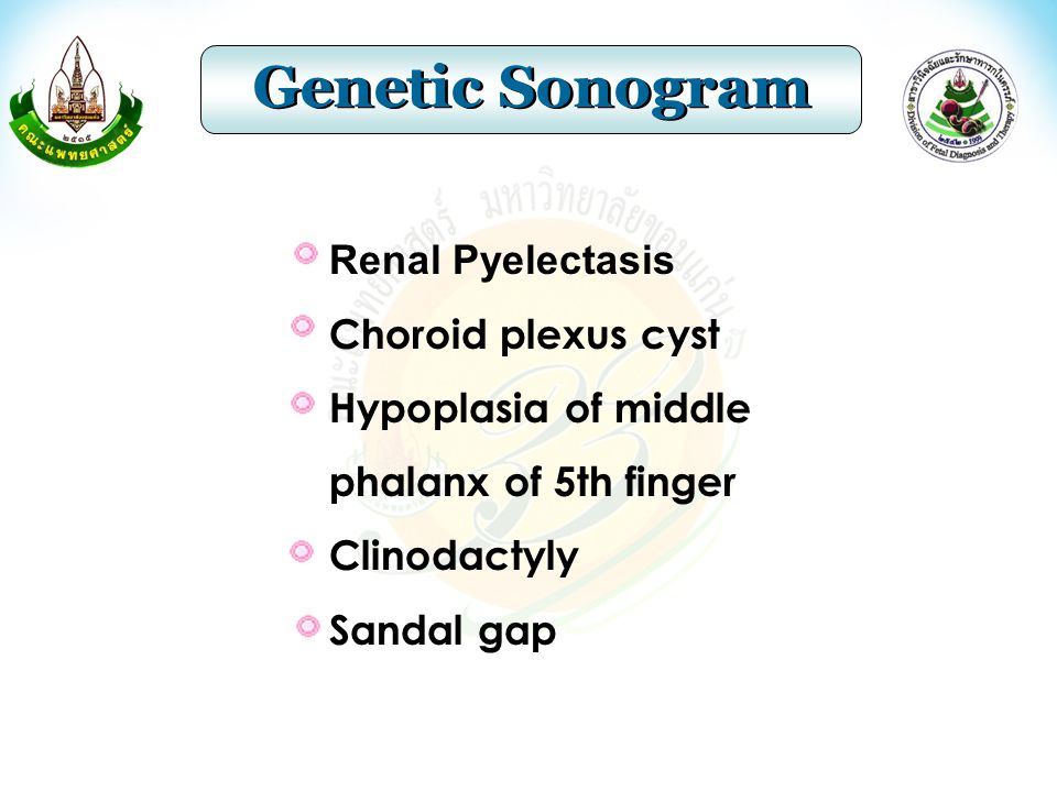 Genetic Sonogram Renal Pyelectasis Choroid plexus cyst