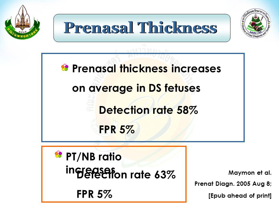 Prenasal Thickness Prenasal thickness increases