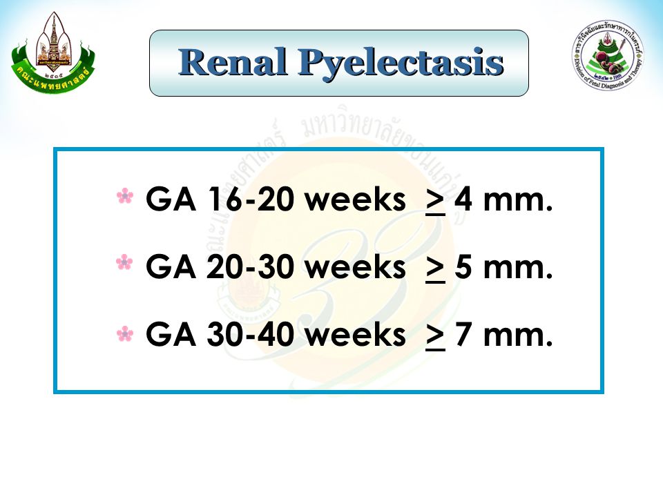 Renal Pyelectasis GA weeks > 4 mm. GA weeks > 5 mm.