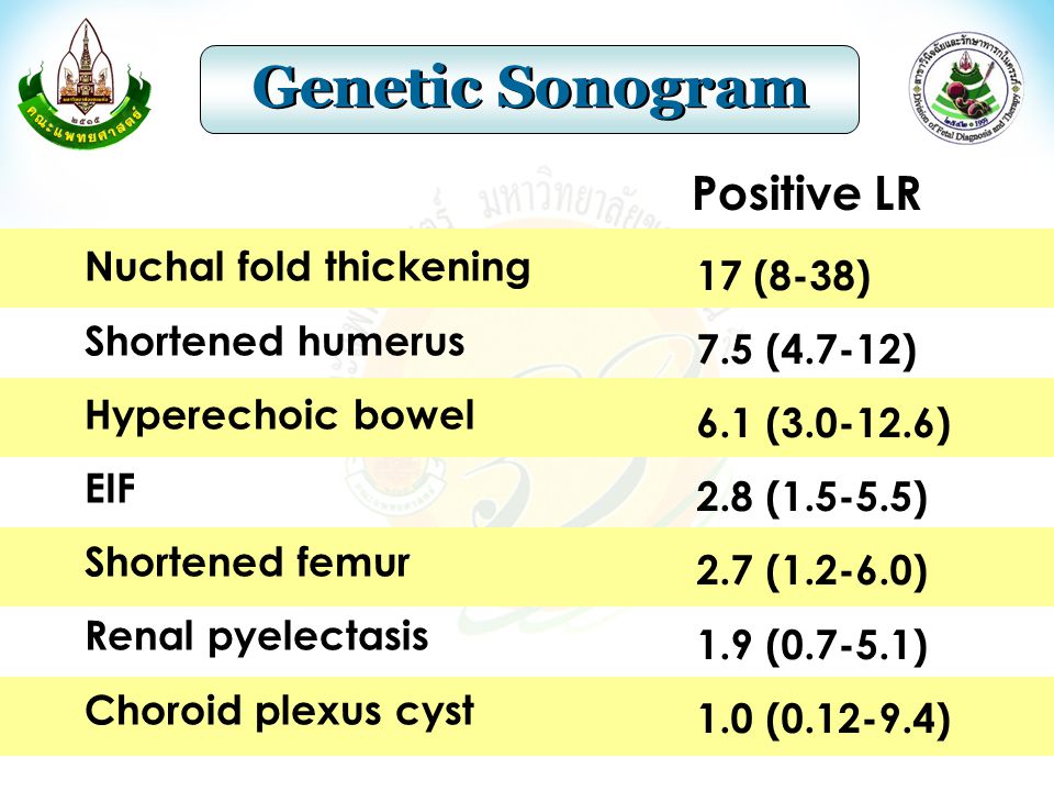 Genetic Sonogram Positive LR Nuchal fold thickening 17 (8-38)
