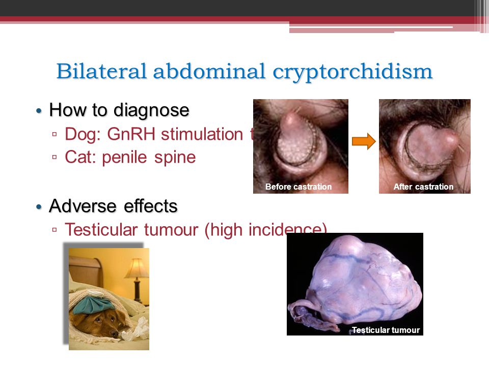 Bilateral abdominal cryptorchidism