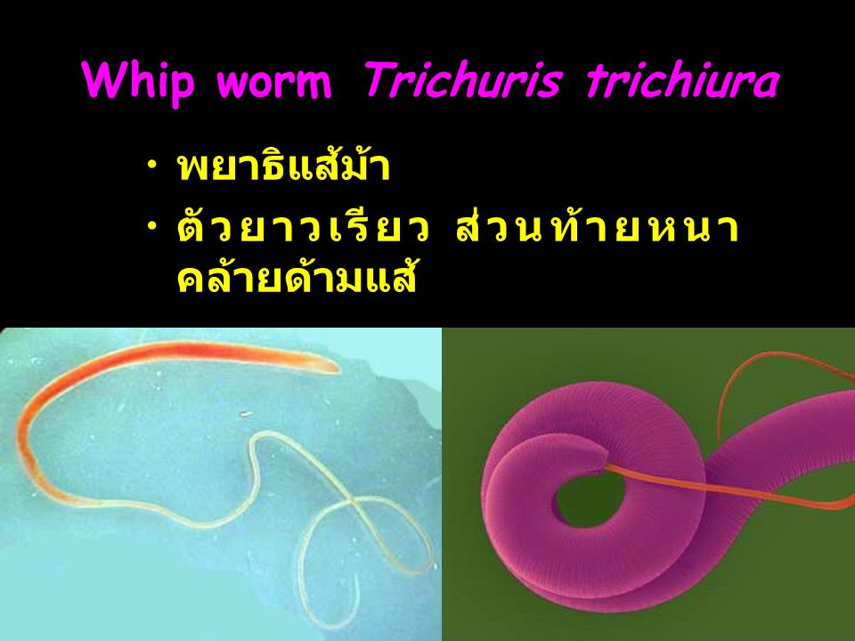 Whip worm Trichuris trichiura