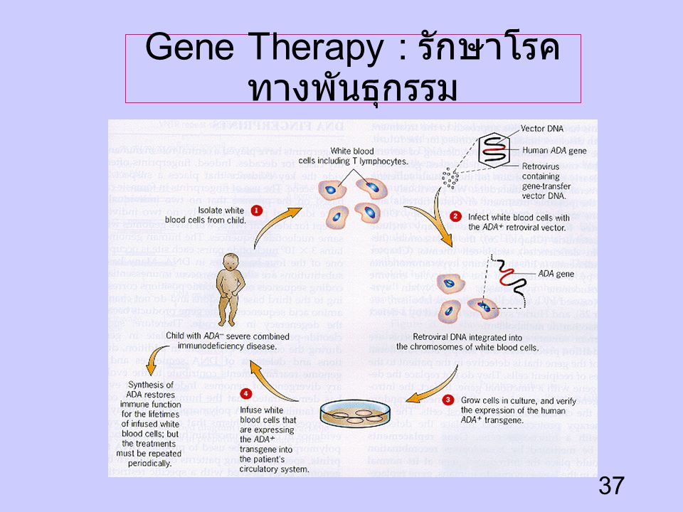 Gene Therapy : รักษาโรคทางพันธุกรรม