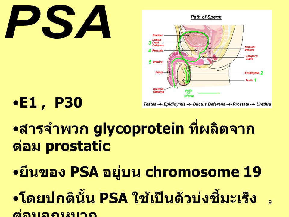 PSA E1 , P30. สารจำพวก glycoprotein ที่ผลิตจากต่อม prostatic.