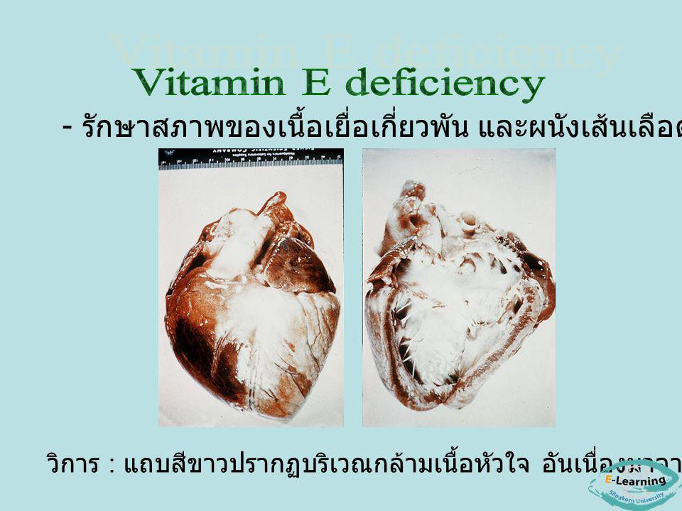 Vitamin E deficiency - รักษาสภาพของเนื้อเยื่อเกี่ยวพัน และผนังเส้นเลือด.