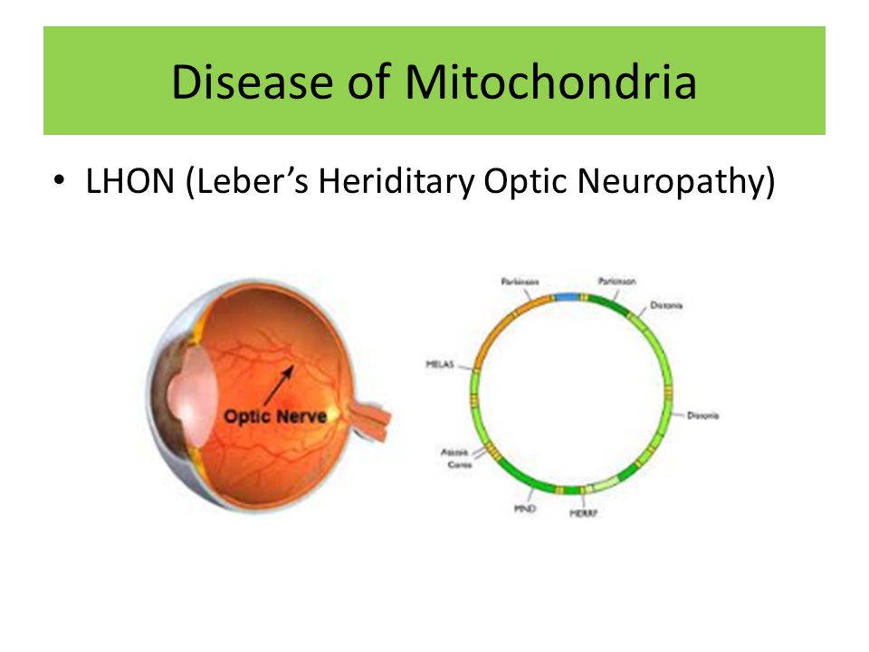 Disease of Mitochondria
