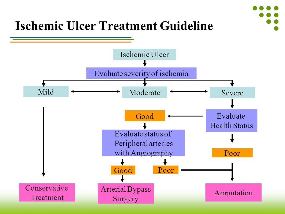 Ischemic Ulcer Treatment Guideline