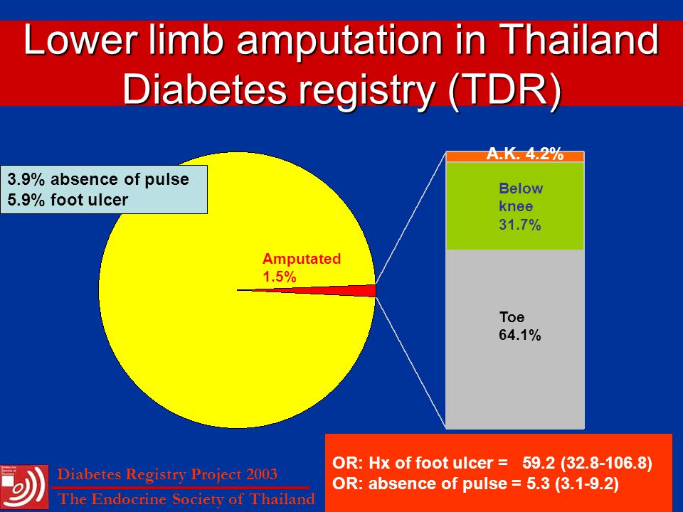 Lower limb amputation in Thailand Diabetes registry (TDR)