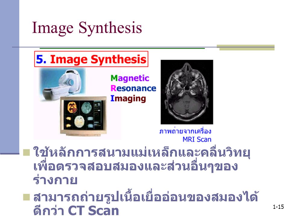 Image Synthesis ใช้หลักการสนามแม่เหล็กและคลื่นวิทยุ เพื่อตรวจสอบสมองและส่วนอื่นๆของร่างกาย. สามารถถ่ายรูปเนื้อเยื่ออ่อนของสมองได้ดีกว่า CT Scan.