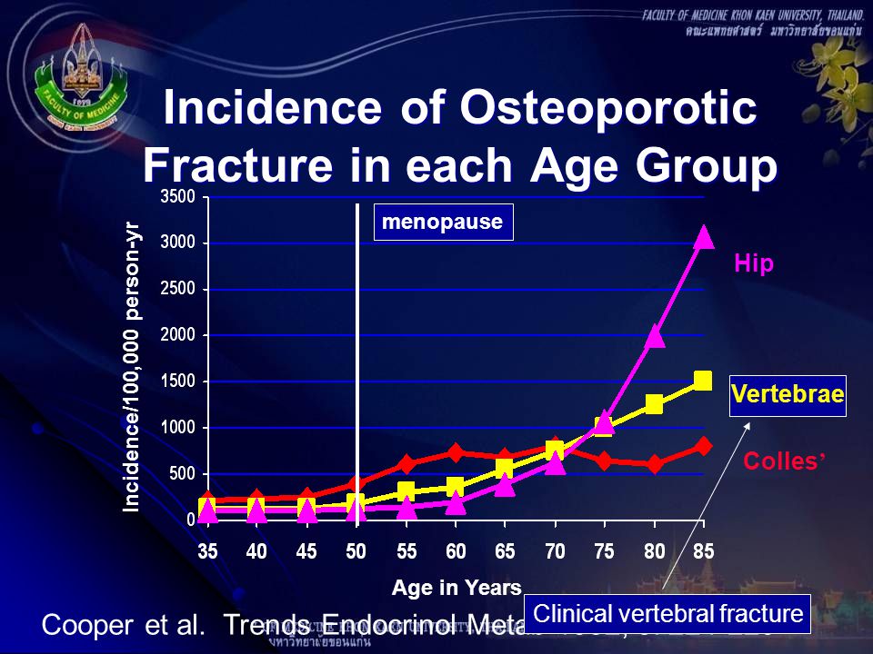 Incidence of Osteoporotic Fracture in each Age Group