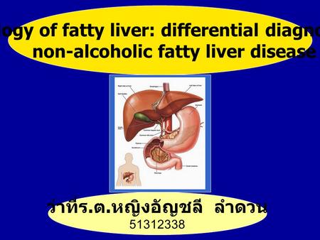 Pathology of fatty liver: differential diagnosis of