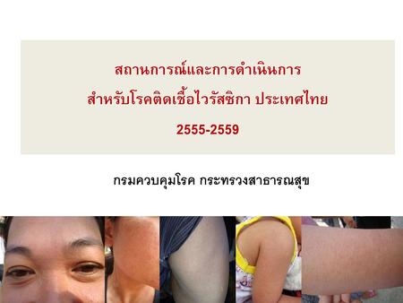 สถานการณ์และการดำเนินการ สำหรับโรคติดเชื้อไวรัสซิกา ประเทศไทย