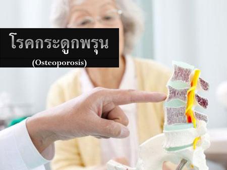 โรคกระดูกพรุน (Osteoporosis).