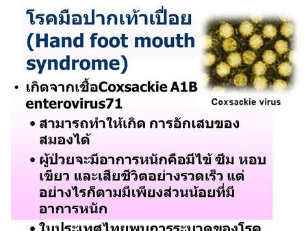โรคมือปากเท้าเปื่อย (Hand foot mouth syndrome)