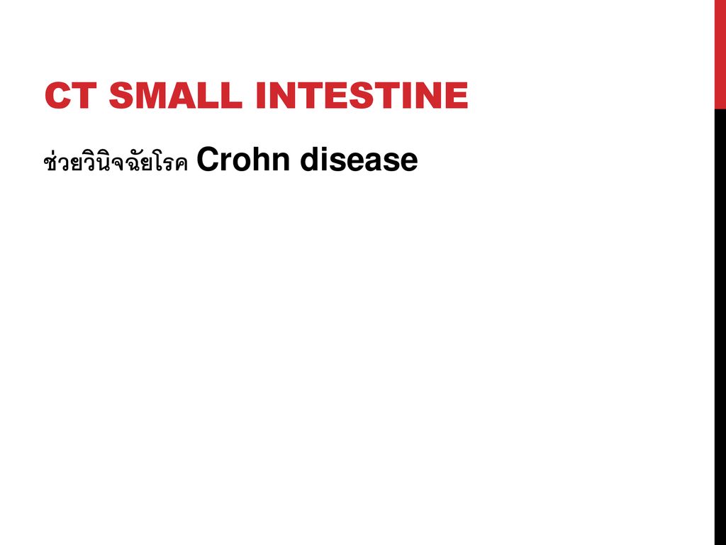 CT small intestine ช่วยวินิจฉัยโรค Crohn disease