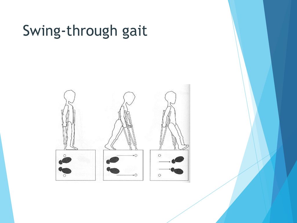 Gait Aids. - ppt ดาวน์โหลด