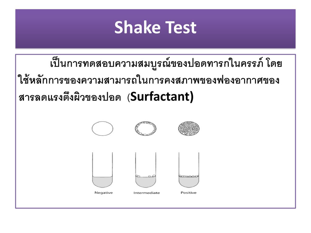 Shake Test เป็นการทดสอบความสมบูรณ์ของปอดทารกในครรภ์ โดยใช้หลักการของความสามารถในการคงสภาพของฟองอากาศของสารลดแรงตึงผิวของปอด (Surfactant)