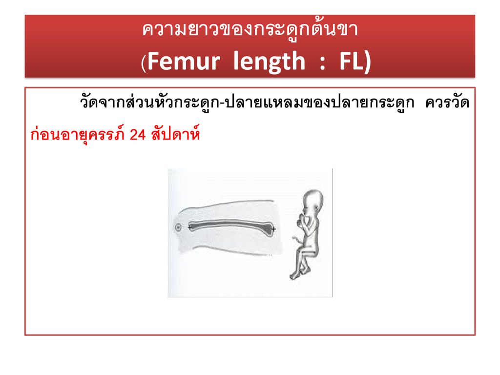 ความยาวของกระดูกต้นขา (Femur length : FL)
