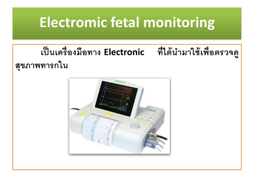 Electromic fetal monitoring