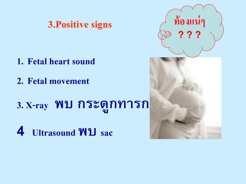 3.Positive signs ท้องแน่ๆ 1. Fetal heart sound 2. Fetal movement