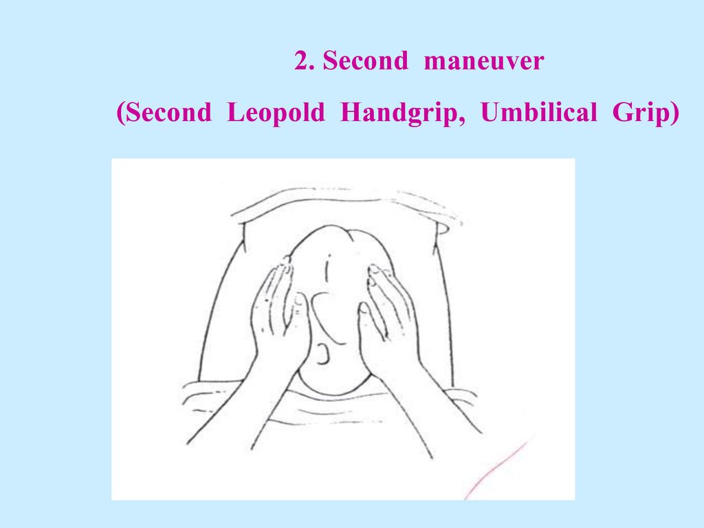 2. Second maneuver (Second Leopold Handgrip, Umbilical Grip)